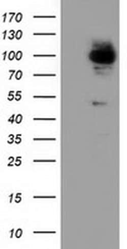 ALDH1L1 Monoclonal Antibody (OTI3B11), TrueMAB , OriGene:Antibodies:Primary