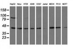 ALDH1L1 Monoclonal Antibody (OTI3B11), TrueMAB , OriGene 30 &mu;L; Unconjugated:Antibodies,