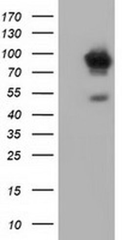 ALDH1L1 Monoclonal Antibody (OTI7G8), TrueMAB , OriGene 30 &mu;L; Unconjugated:Antibodies,