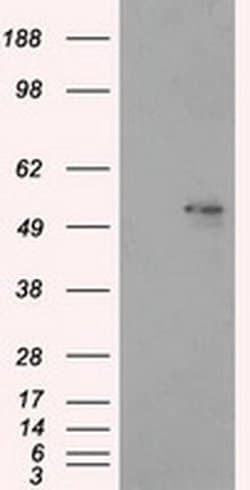 ALDH3A1 Mouse anti-Human, Clone: OTI1C6, TrueMAB , Origene 30 &mu;L; Unconjugated:Antibodies,