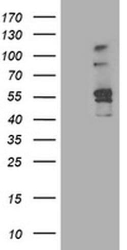 ALDH3A2 Monoclonal Antibody (OTI1H10), TrueMAB , OriGene 100 &mu;L; Unconjugated:Antibodies,