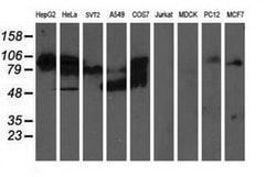 ALDH3A2 Monoclonal Antibody (OTI1H10), TrueMAB , OriGene 100 &mu;L; Unconjugated:Antibodies,