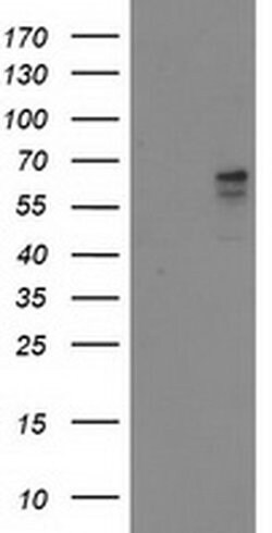ALDH3A2 Monoclonal Antibody (OTI1D1), TrueMAB , OriGene 100 &mu;L; Unconjugated:Antibodies,