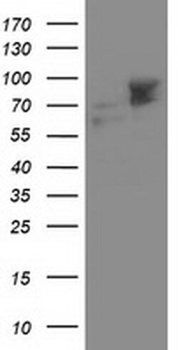 ALDH3A2 Monoclonal Antibody (OTI 1B11), TrueMAB , OriGene:Antibodies:Primary