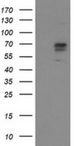 ALDH3A2 Mouse anti-Human, Clone: OTI1H4, lyophilized, TrueMAB 100 &mu;g;
