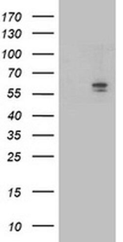 ALDH3A2 Monoclonal Antibody (OTI2D3), TrueMAB , OriGene 100 &mu;L; Unconjugated:Anticuerpos