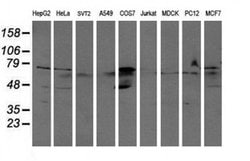 ALDH3A2 Monoclonal Antibody (OTI2D3), TrueMAB , OriGene 100 &mu;L; Unconjugated:Anticuerpos