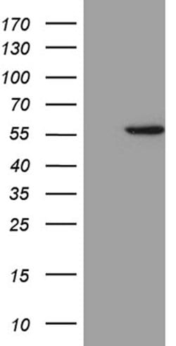 ALDH3B1 Mouse anti-Human, Clone: OTI2F6, lyophilized, TrueMAB 100 &mu;g;