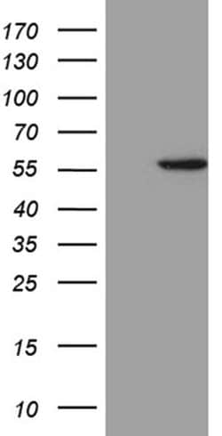 ALDH3B1 Mouse anti-Human, Clone: OTI2F6, liquid, TrueMAB 100 &mu;L; Unconjugated:Antibodies,