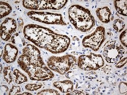 ALDH4A1 Mouse anti-Canine, Human, Rat, Clone: OTI1H10, lyophilized, TrueMAB