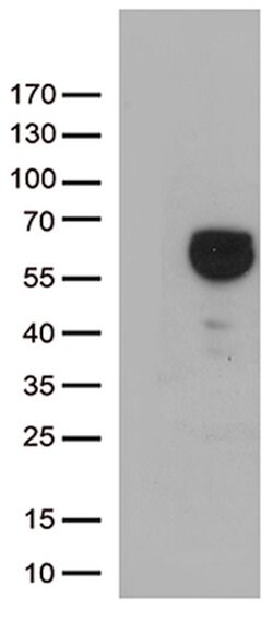 ALDH4A1 Mouse anti-Canine, Human, Rat, Clone: OTI1H10, lyophilized, TrueMAB