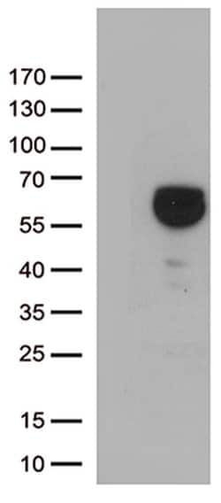 ALDH4A1 Monoclonal Antibody (OTI1H10), TrueMAB , OriGene 100 &mu;L; Unconjugated:Antibodies,
