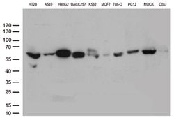 ALDH4A1 Mouse anti-Canine, Human, Rat, Clone: OTI1H10, lyophilized, TrueMAB