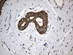 ALDH7A1 Monoclonal Antibody (OTI10A12), TrueMAB , OriGene 30 &mu;L | Buy Online | Origene Technologies | Fisher Scientific