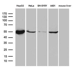 ALDH7A1 Monoclonal Antibody (OTI10A12), TrueMAB , OriGene 30 &mu;L | Buy Online | Origene Technologies | Fisher Scientific