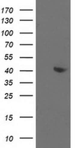 ALDOB Mouse anti-Human, Clone: OTI3C6, liquid, TrueMAB 100 &mu;L; Unconjugated:Antibodies,