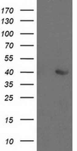ALDOB Mouse anti-Human, Clone: OTI3E10, liquid, TrueMAB 100 &mu;L; Unconjugated:Antibodies,