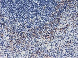 ALG2 Mouse anti-Human, Clone: OTI1E7, lyophilized, TrueMAB 100 &mu;g; Unconjugated:Antibodies,