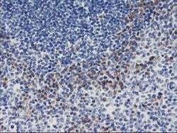 ALG2 Monoclonal Antibody (OTI1E7), TrueMAB , OriGene:Antibodies:Primary