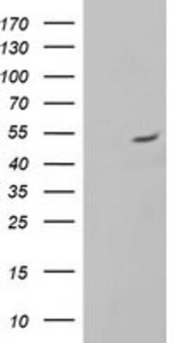 ALG2 Mouse anti-Human, Clone: OTI1E7, lyophilized, TrueMAB 100 &mu;g; Unconjugated:Antibodies,