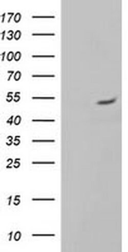ALG2 Monoclonal Antibody (OTI1E7), TrueMAB , OriGene 100 &mu;L; Unconjugated:Antibodies,