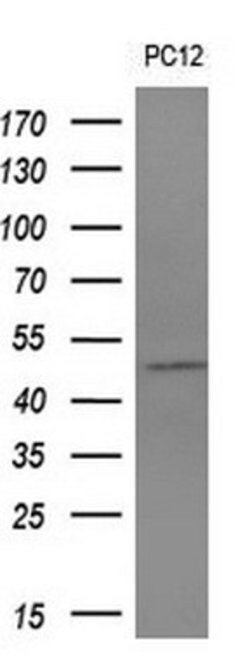 ALG2 Mouse anti-Human, Clone: OTI1E7, lyophilized, TrueMAB 100 &mu;g; Unconjugated:Antibodies,