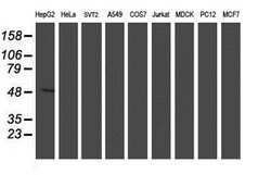 ALG2 Mouse anti-Human, Clone: OTI3C2, lyophilized, TrueMAB 100 &mu;g; Unconjugated:Antibodies,