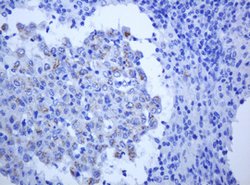 ALK Mouse anti-Human, Clone: OTI1E12, lyophilized, TrueMAB 100 &mu;g; Unconjugated:Antibodies,