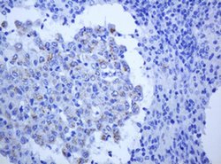 ALK Monoclonal Antibody (OTI1E12), TrueMAB , OriGene 100 &mu;L; Unconjugated:Antibodies,
