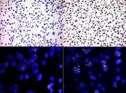 ALK Mouse anti-Human, Clone: OTI1A4, lyophilized, UltraMAB 100 &mu;g | Buy Online | OriGene | Fisher Scientific