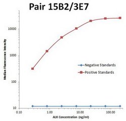 ALK Monoclonal Antibody (OTI3E7), TrueMAB , OriGene 100 &mu;L; Unconjugated:Antibodies,