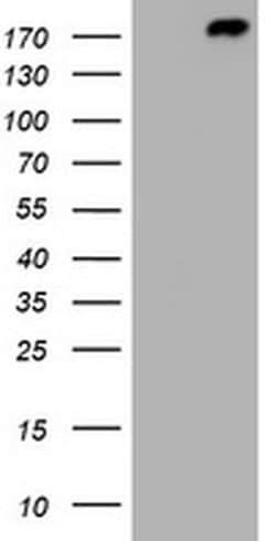 ALK Monoclonal Antibody (OTI5C8), TrueMAB , OriGene 100 &mu;L; Unconjugated:Antibodies,