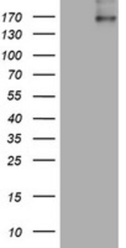 ALK Mouse anti-Human, Clone: OTI1D4, lyophilized, TrueMAB 100 &mu;g; Unconjugated:Antibodies,