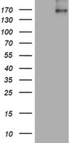ALK Monoclonal Antibody (OTI1D4), TrueMAB , OriGene 100 &mu;L; Unconjugated:Antibodies,