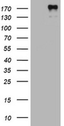 ALK Monoclonal Antibody (OTI1E12), TrueMAB , OriGene 100 &mu;L; Unconjugated:Antibodies,