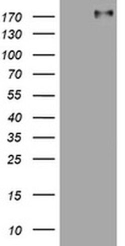 ALK Monoclonal Antibody (OTI1D7), TrueMAB , OriGene 100 &mu;L; Unconjugated:Antibodies,