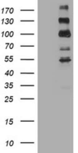 ALK Rat anti-Human, Clone: OTI8G7, lyophilized, TrueMAB 100 &mu;g; Unconjugated:Antibodies,