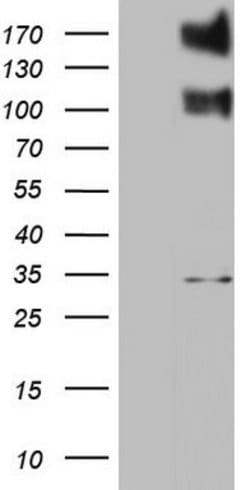 ALK Rat anti-Human, Clone: OTI13A1, lyophilized, TrueMAB 100 &mu;g; Unconjugated:Antibodies,