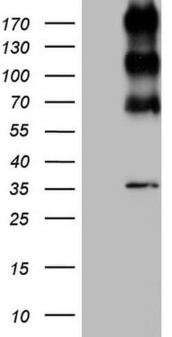 ALK Monoclonal Antibody (OTI9H10), TrueMAB , OriGene 30 &mu;L; Unconjugated:Antibodies,