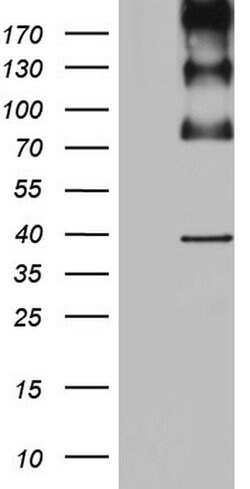 ALK Monoclonal Antibody (OTI1C6), TrueMAB , OriGene:Antibodies:Primary