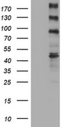 ALK Monoclonal Antibody (OTI1D9), TrueMAB , OriGene 30 &mu;L | Buy Online | Origene Technologies | Fisher Scientific