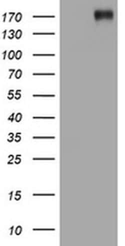 ALK Monoclonal Antibody (OTI3E7), TrueMAB , OriGene 100 &mu;L; Unconjugated:Antibodies,