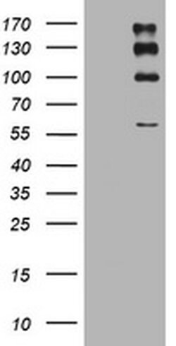 ALK Monoclonal Antibody (OTI6E11), TrueMAB , OriGene 100 &mu;L; Unconjugated:Antibodies,