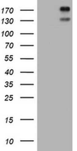 ALK Monoclonal Antibody (OTI5B9), TrueMAB , OriGene 100 &mu;L; Unconjugated:Antibodies,