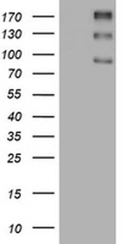 ALK Monoclonal Antibody (OTI1A12), TrueMAB , OriGene 100 &mu;L; Unconjugated:Antibodies,