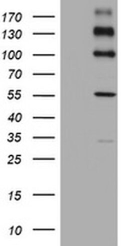 ALK Monoclonal Antibody (OTI15B2), TrueMAB , OriGene 100 &mu;L; Unconjugated:Antibodies,