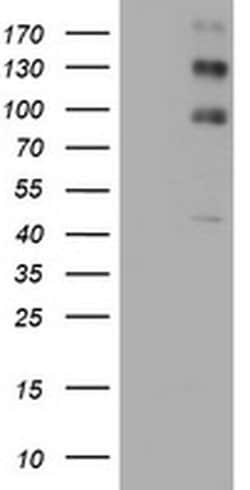 ALK Monoclonal Antibody (OTI2H1), TrueMAB , OriGene:Antibodies:Primary