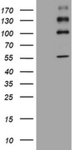 ALK Monoclonal Antibody (OTI2B3), TrueMAB , OriGene 100 &mu;L; Unconjugated:Antibodies,