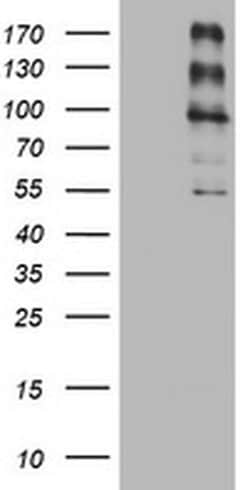 ALK Monoclonal Antibody (OTI7D6), TrueMAB , OriGene 100 &mu;L; Unconjugated:Antibodies,