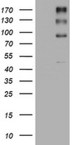 ALK Monoclonal Antibody (OTI14F11), TrueMAB , OriGene 100 &mu;L; Unconjugated:Antibodies,